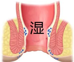 运城众泰肛肠医院：肛门湿疹的危害不可不知