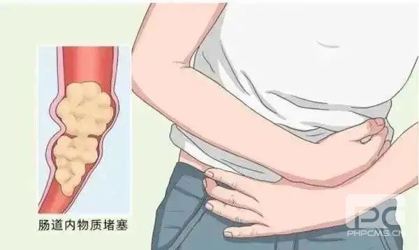 运城众泰肛肠医院：长期便秘临床症状是什么？