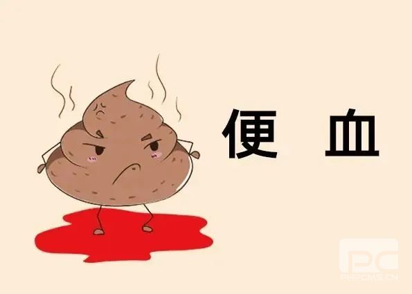 运城众泰肛肠医院：内痔不管可诱发多种疾病