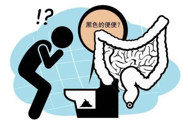 运城众泰肛肠医院：拉黑便是什么原因?