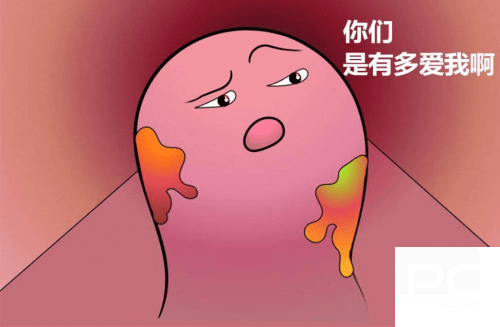 运城众泰肛肠医院：不同类型外痔要怎么处理？