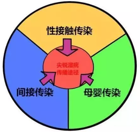 运城肛肠医院:肛门瘙痒?警惕肛门尖锐湿疣~~