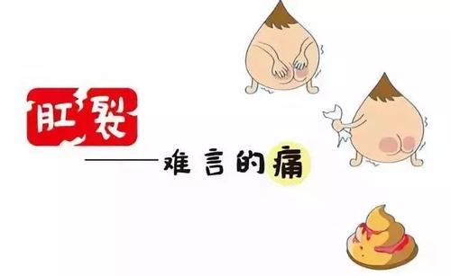 运城众泰肛肠医院:肛裂有5大危害不得不重视