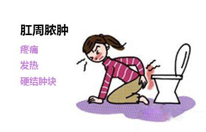 运城众泰肛肠医院:是怎么样发生肛周脓肿的?