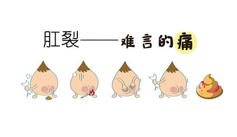 运城众泰肛肠医院：肛裂----难言的痛