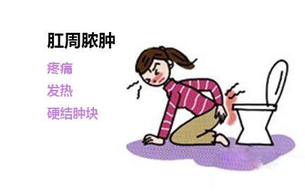 运城众泰肛肠医院：肛周脓肿临床表现