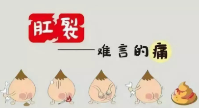 运城众泰肛肠医院：肛裂的4大症状，一个比一个“闹心”！