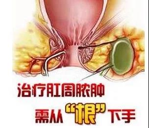 运城众泰肛肠医院：屁股“发烧”竟是这个病？