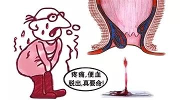 运城众泰肛肠医院：大便出血可能是哪些疾病？
