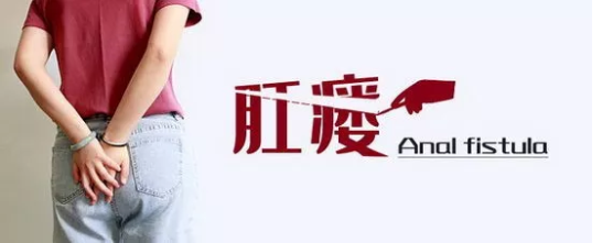 运城众泰肛肠医院：肛瘘是怎么回事？