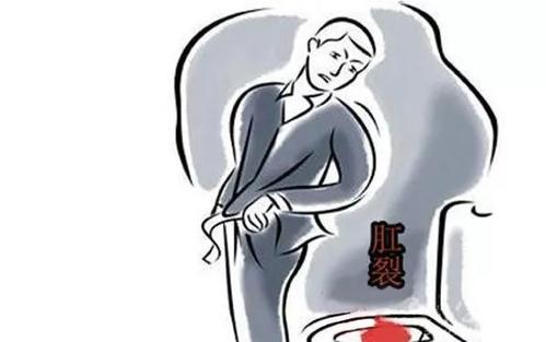 运城众泰肛肠医院： 肛裂患者的日常生活保健