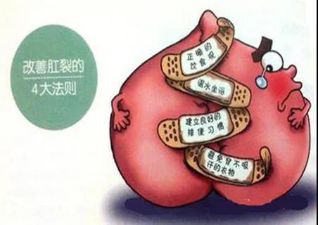 运城众泰肛肠医院：肛裂究竟用药还是手术？哪个效果好？