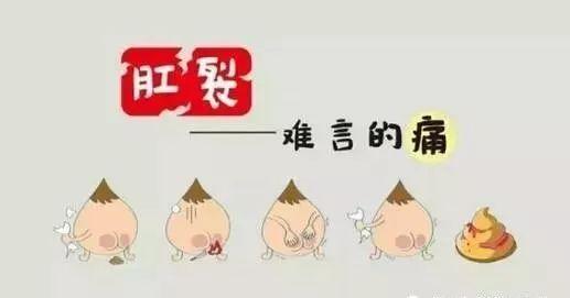 运城众泰肛肠医院：肛裂病因概述