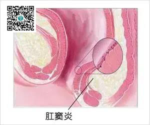 运城众泰肛肠医院：「菊」部疼痛不一定是肛裂，还可能是这6个问题！