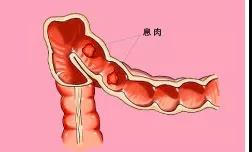 息肉：能和你们提起运城众泰 说明我不算太坏