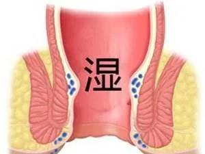运城众泰肛肠医院：关于肛周湿疹，这些知识点很重要