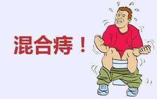 运城众泰肛肠医院：混合痔早期和晚期有什么不同？